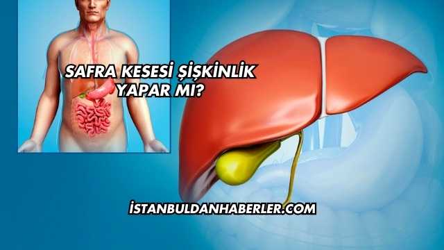 Safra Kesesi Şişkinlik Yapar mı?